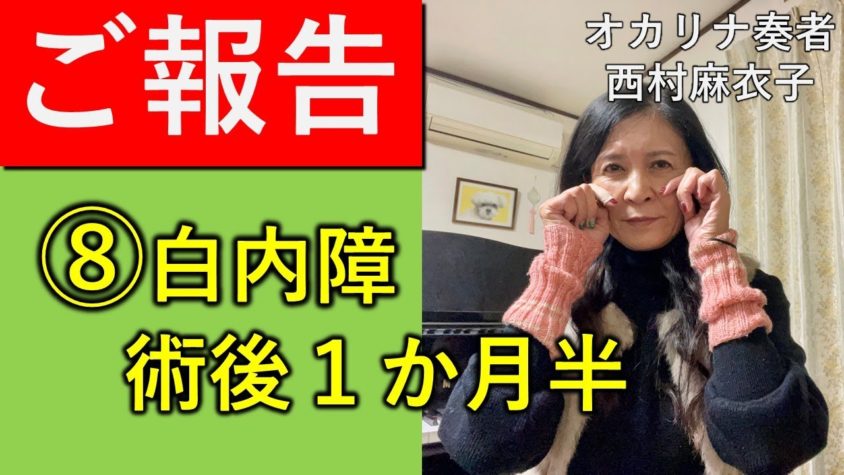 白内障手術（多焦点眼内レンズ）体験談⑧術後１か月半ご報告