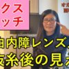 白内障手術（多焦点眼内レンズ）体験談⑮白内障レンズ入替、抜糸後の見え方と今後