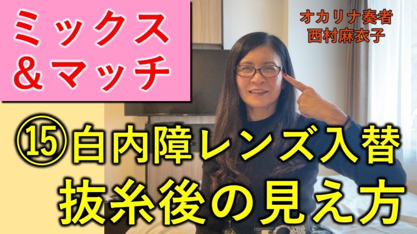 白内障手術（多焦点眼内レンズ）体験談⑮白内障レンズ入替、抜糸後の見え方と今後