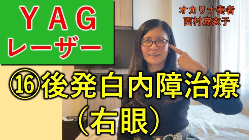 白内障手術（多焦点眼内レンズ）体験談⑯後発白内障治療 YAGレーザー